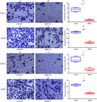 Long Non Coding Rna Linc Regulates Proliferation Migration And