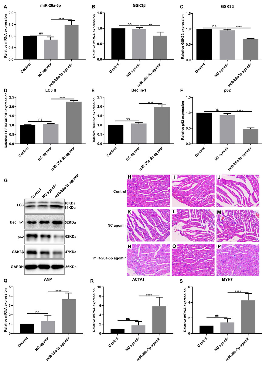 MiR 26a 5p inhibits GSK3β expression and promotes cardiac hypertrophy