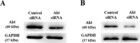 Targeting Secretory Leukocyte Protease Inhibitor Slpi Inhibits