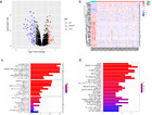 Identification Of A Three Gene Based Prognostic Model In Multiple