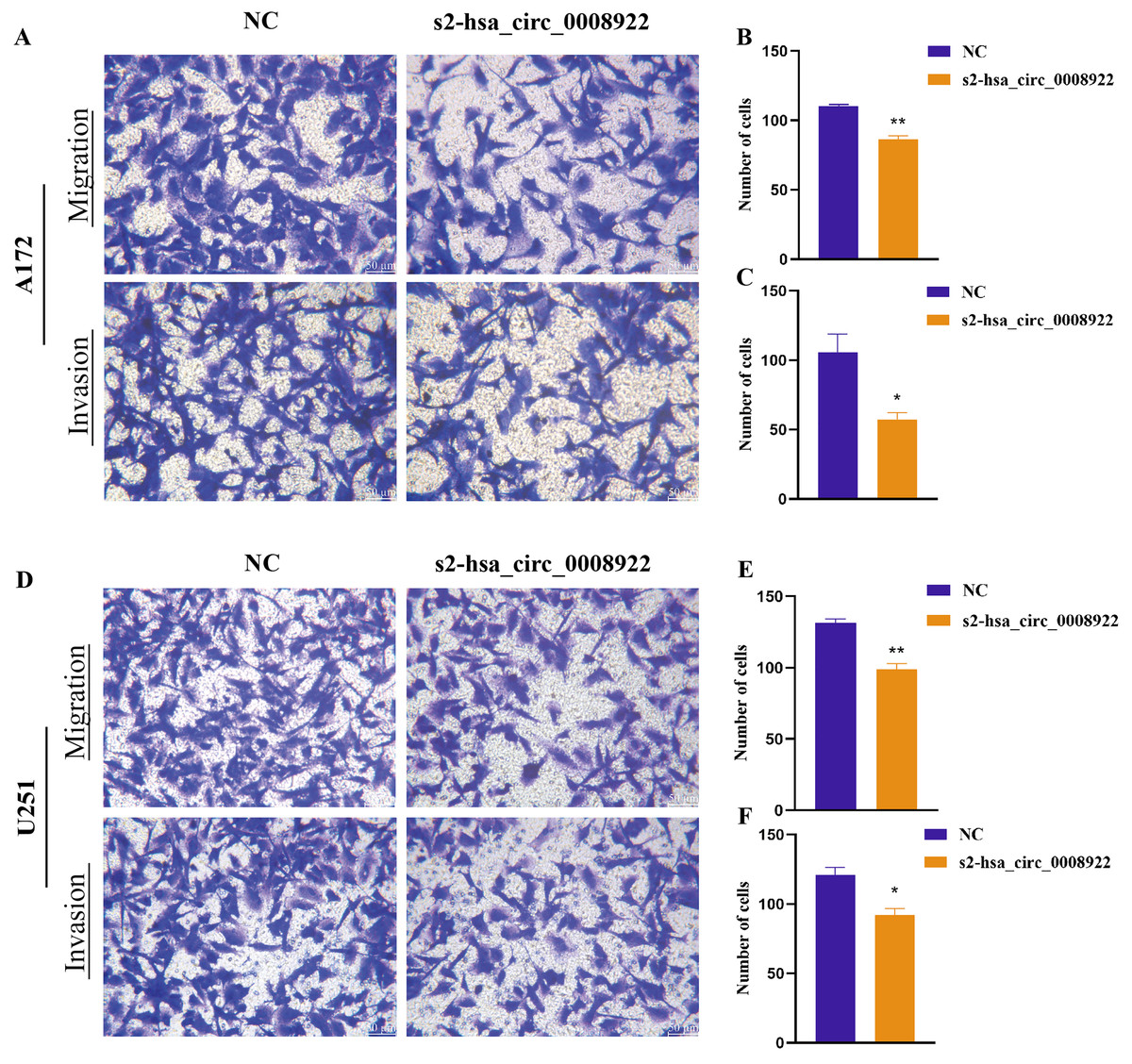 Knockdown Of Hsa Circ Inhibits The Progression Of Glioma Peerj