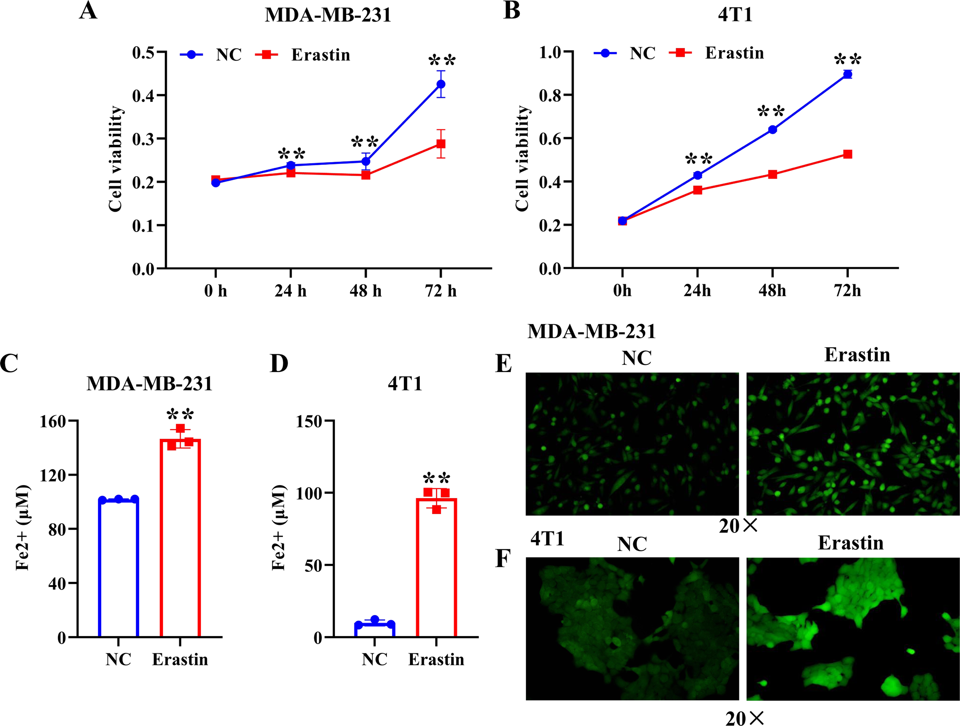 Ferroptosis Dependent Breast Cancer Cell Derived Exosomes Inhibit