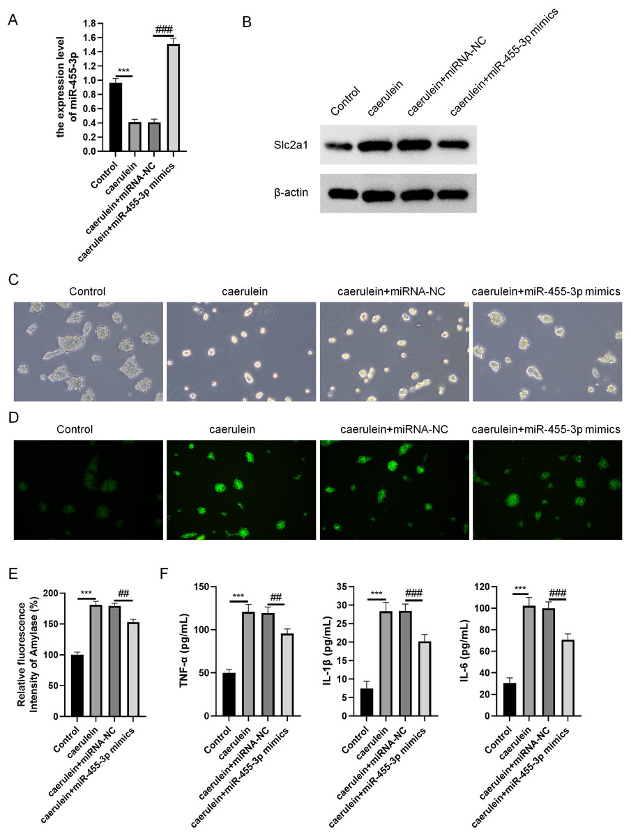 Mir P Ameliorates Pancreatic Acinar Cell Injury By Targeting