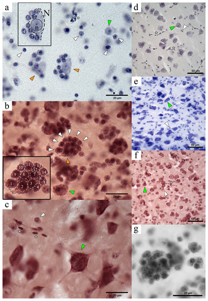 Microphotographs of PGCs in the NC crow telencephalon. Orange arrowheads indicate neurons within a PGC and green arrows indicate unclustered neurons. White arrowheads show perineuronal glia, and the asterisks indicate presence of blood vessels or blood cells.