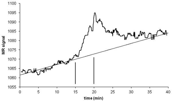 Time-signal curve in an a priori midbrain VOI from the single-dose fMRI experiment described in Methods.