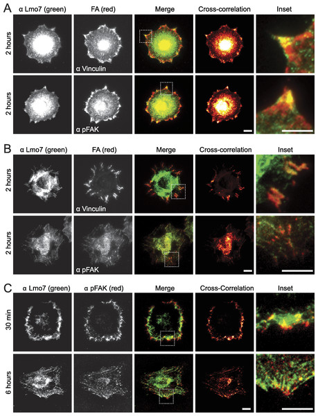 Endogenous Lmo7 co-localizes with vinculin and pFAK at focal adhesions in HeLa cells.