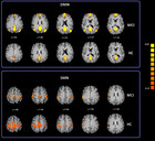 Characterization of resting state activity in MCI individuals [PeerJ]