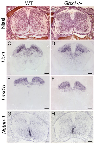 Absence of morphological and molecular abnormalities in the developing dorsal horn of Gbx1−/− mice.