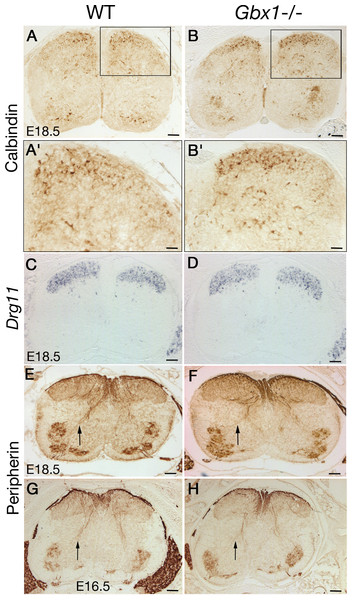 Developmental progression of afferent projections in the dorsal horn of Gbx1−/− mice.
