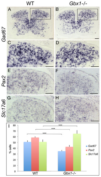 Abnormal GABAergic differentiation in Gbx1−/− mice.