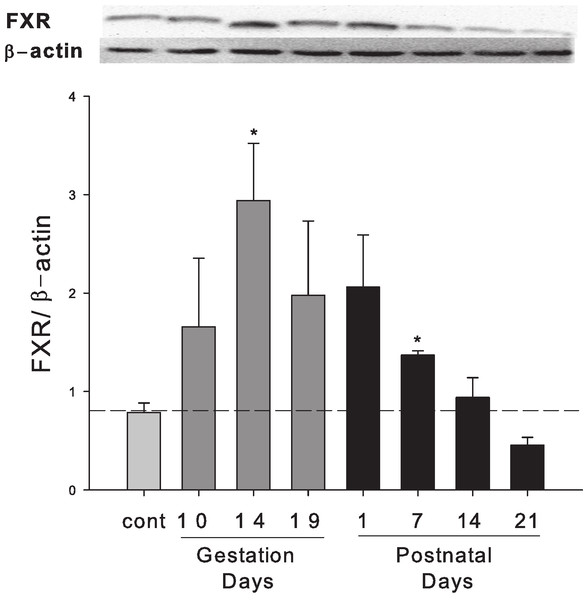 Hepatic expression of nuclear receptor FXR in pregnant and lactating rats.