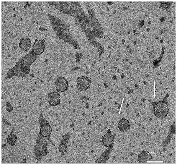 TEM image of the exosomes produces by MDA-MB-436 cell line.