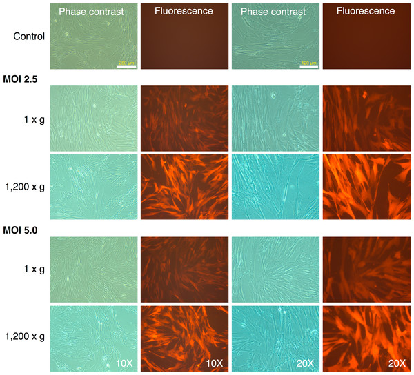 Spin-transduction of human fibroblasts with gammaretroviral vector is more efficient than transduction at unit gravity.