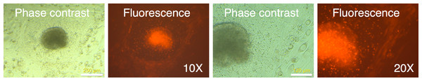 Putative IPSC colony showing mRFP1-positive and mRPF1-negative cells.