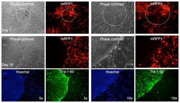 Live staining of mRFP1-negative colony for Tra-1-60 surface antigen.