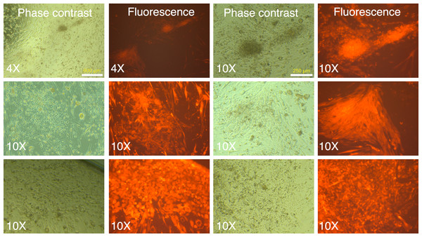 mRFP1-positive colonies and cell aggregates seen during reprogramming of human fibroblasts on mouse feeder cells.