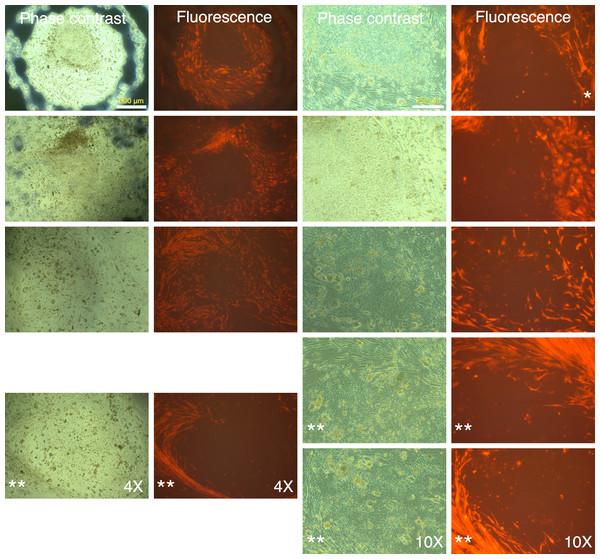 mRFP-1 negative putative IPSC colonies on mouse feeder cells.