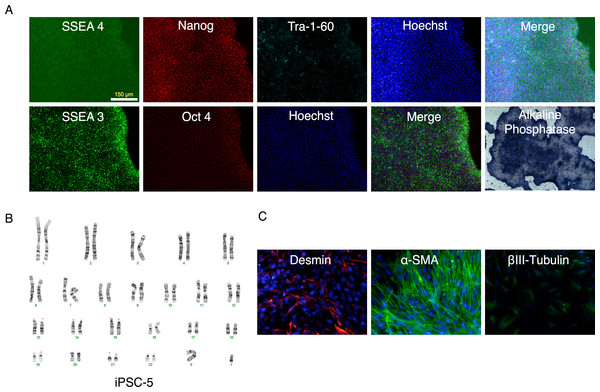 Characterization of putative iPSC-5 clone.