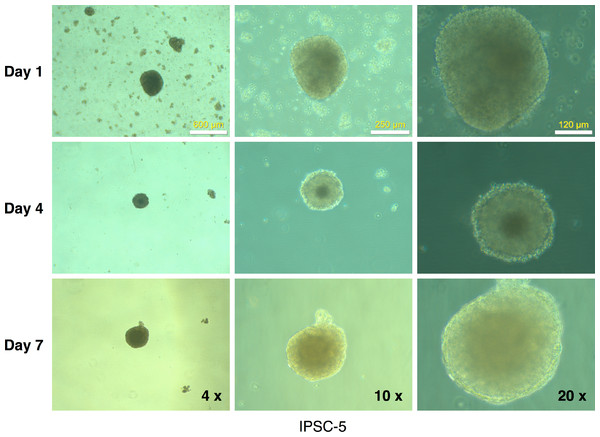 Embryoid body derivation from an mRFP1-negative iPSC clone.