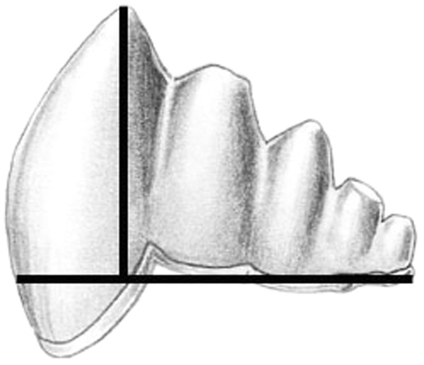 Cusp pointedness measurement.