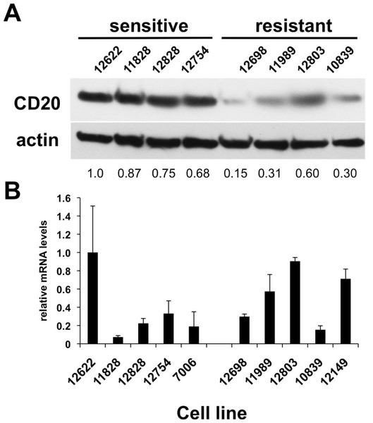 CD20 protein and mRNA levels in sensitive or resistant lymphoblastoid cell lines.
