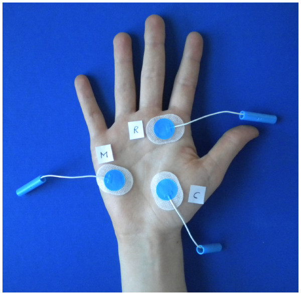 Placement of electrodes.