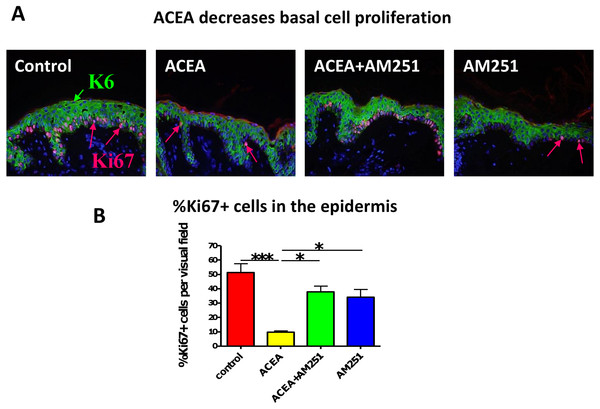 The CB1 specific agonist, ACEA significantly decreases human epidermal keratinocyte proliferation in situ.