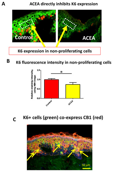 The CB1 specific agonist, ACEA, significantly decreases K6 expression in suprabasal cells in a proliferation-independent manner.