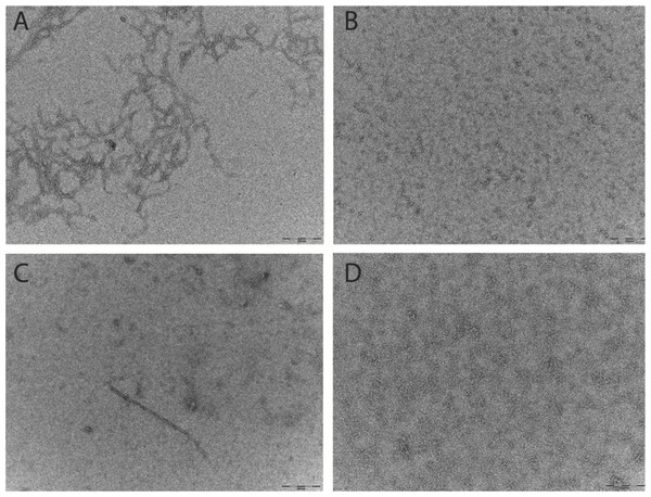 Pretreatment method determines the starting aggregation state of Aβ42 as determined by transmission electron microscopy.