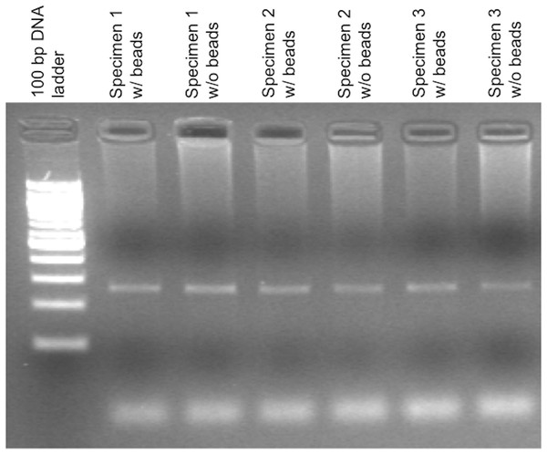 Agarose gel electrophoresis demonstrating control amplification reactions for a PCR-based IGH-BCL2 translocation assay.