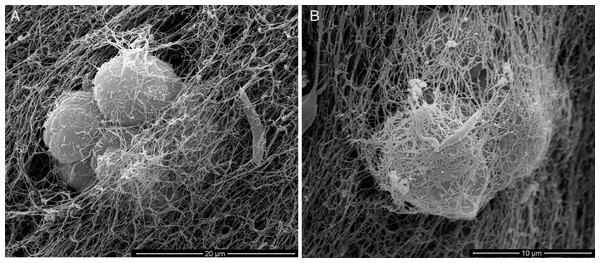 SEM of L. amazonensis–macrophages 3D interaction.