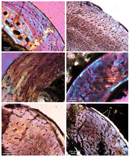 Bone microstructure in selected Permo-Triassic baurioid eutherocephalians.