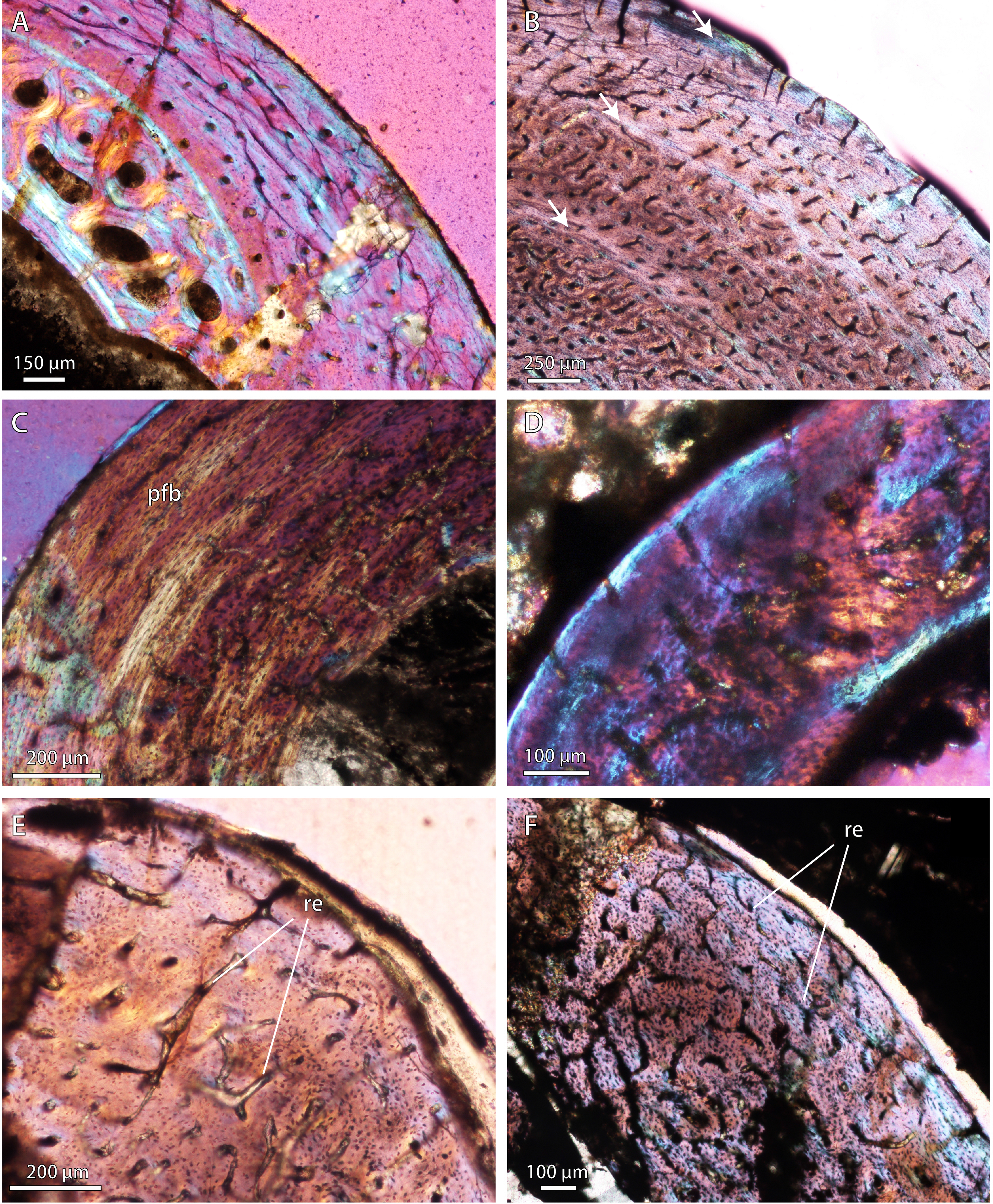 bone microstructure and the evolution of growth patterns