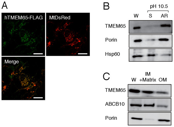 Analysis of intra-mitochondrial localization of hTMEM65.