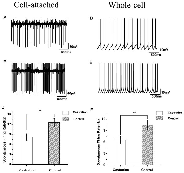 The spontaneous firing of RA PNs in the cell-attached and whole-cell configuration.