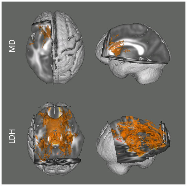 Results from the tract-based spatial statistics (TBSS) analyses depicting the voxels that showed significant associations between head motion and diffusion metrics.
