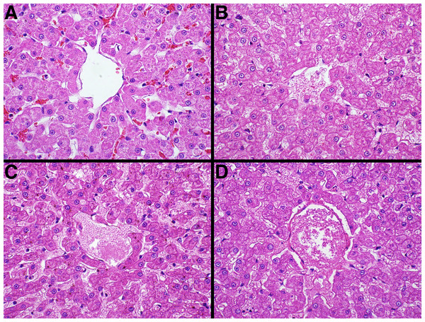 Representative fixative histomorphology—liver.