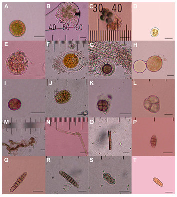 First evidence of bryophyte diaspores in the plumage of transequatorial ...