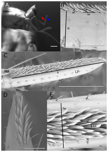 Scanning electron micrographs of hermit crab anntenules.