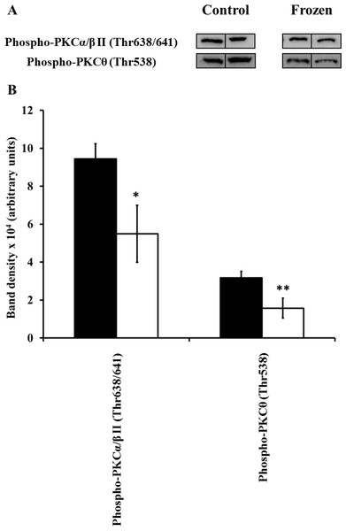 Changes in phosphorylation levels of PKC isozymes in frog hind leg skeletal muscle during freezing.