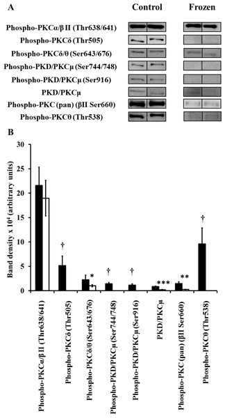 Changes in phosphorylation levels of PKC isozymes in frog liver during freezing.