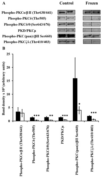 Changes in phosphorylation levels of PKC isozymes in frog kidney during freezing.