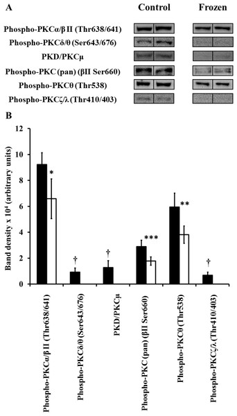 Changes in phosphorylation levels of PKC isozymes in frog heart during freezing.