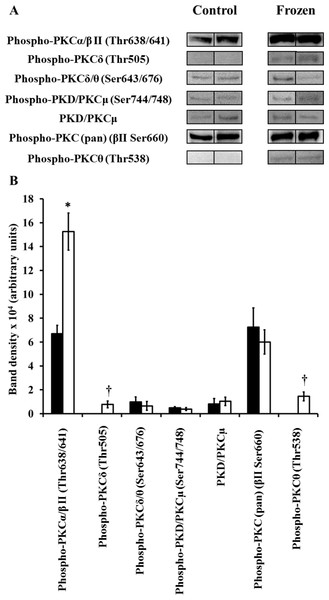 Changes in phosphorylation levels of PKC isozymes in frog brain during freezing.