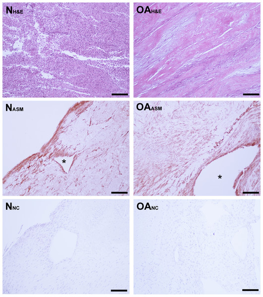 Bioscaffold cellularity and alpha-smooth muscle actin expression.