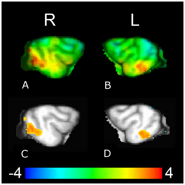 Whole-brain group analysis of the interaction between BOLD time course in the left and the right caudate seeds and signal presentations—warmer colors here represent increased functional coupling with the caudate seed during presentations of the reward versus no-reward signals across all three source conditions (familiar human, unfamiliar human, computer).