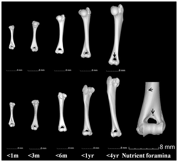 Gross anatomical features of the humerus.