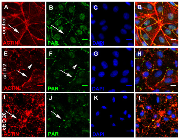 Cytochalasin D induced PAR delocalization together with actin depolymerization.