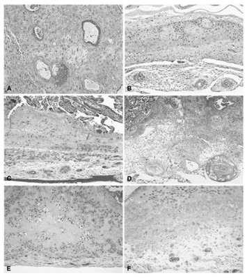 Placental vascular pathology and increased thrombin generation as ...