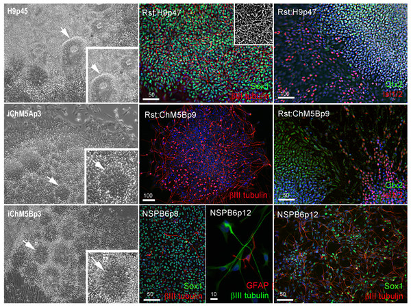 Neural differentiation potential of candidate iChM5 lines.